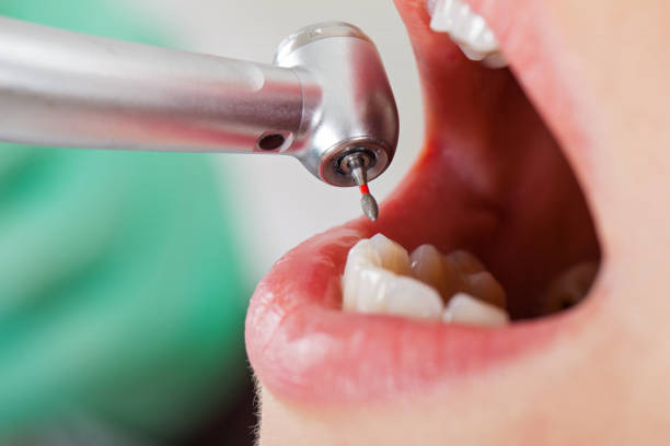 Best Emergency Treatment for Dental Infections or Abscesses in Brookside, AL